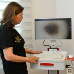 dermatoskop ile ben muayenesi