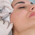 Göz Altı Işık Dolgusu