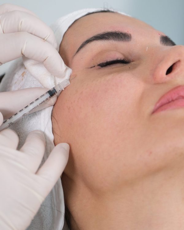 Göz Altı Işık Dolgusu